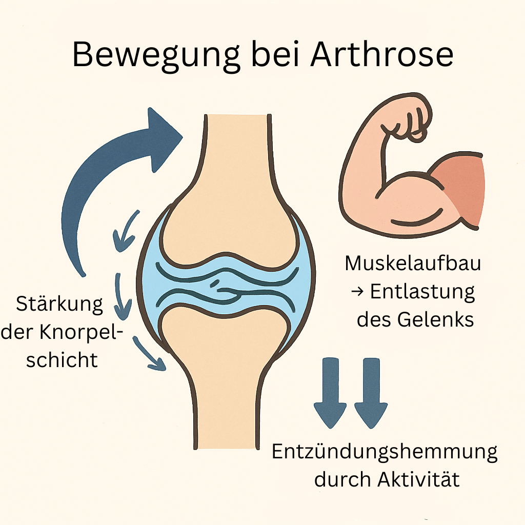 Grafik zur Veranschaulichung des Nutzens von Bewegung bei Arthrose